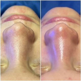 Cure de 4 traitements traitements est idéale 1 x mois Cure de 4 traitements traitements est idéale 1 x mois